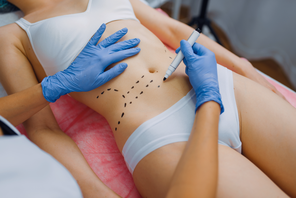 Liposuction Contouring